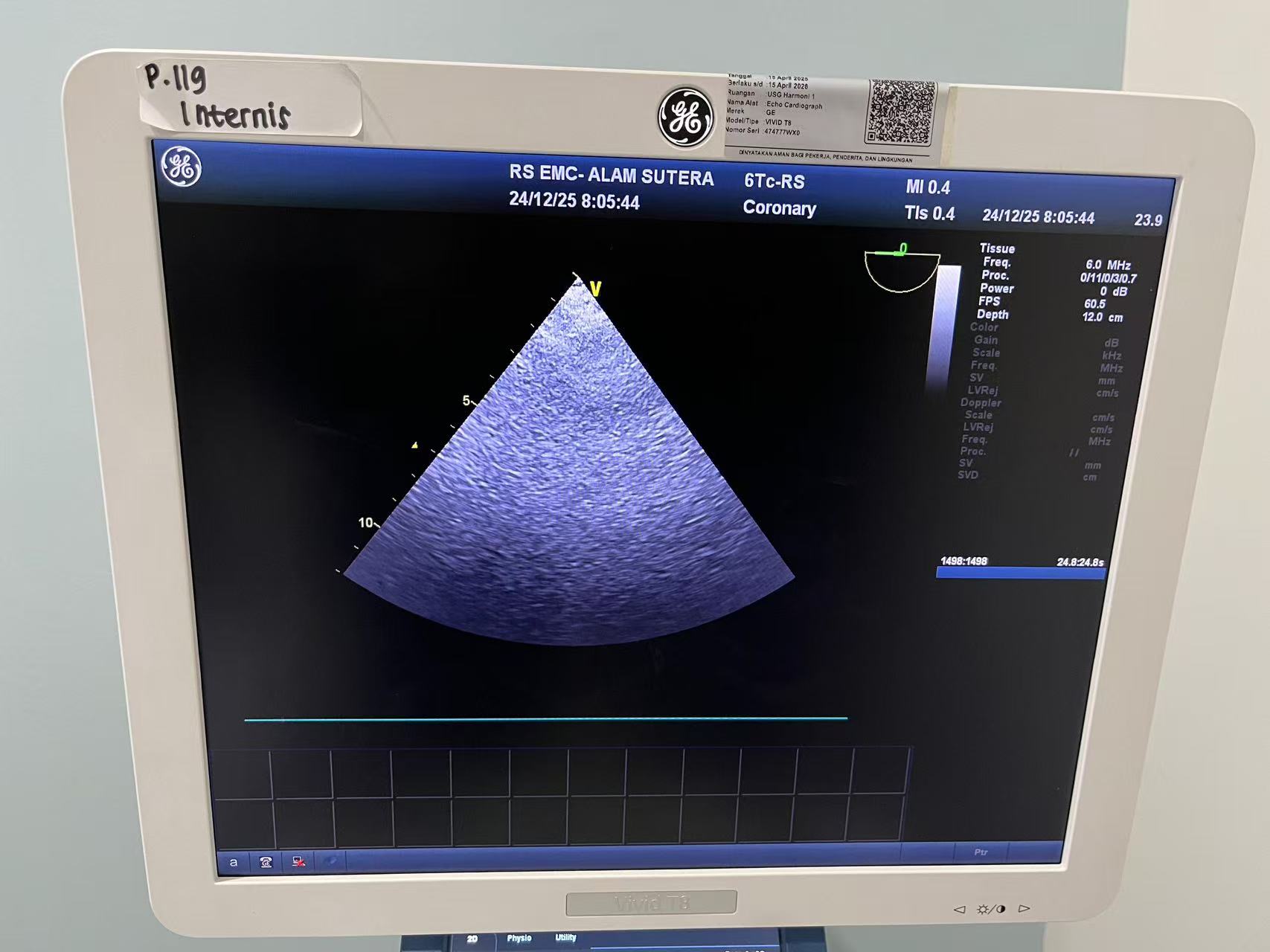 经食道探头GE 6Tc-RS (图2)