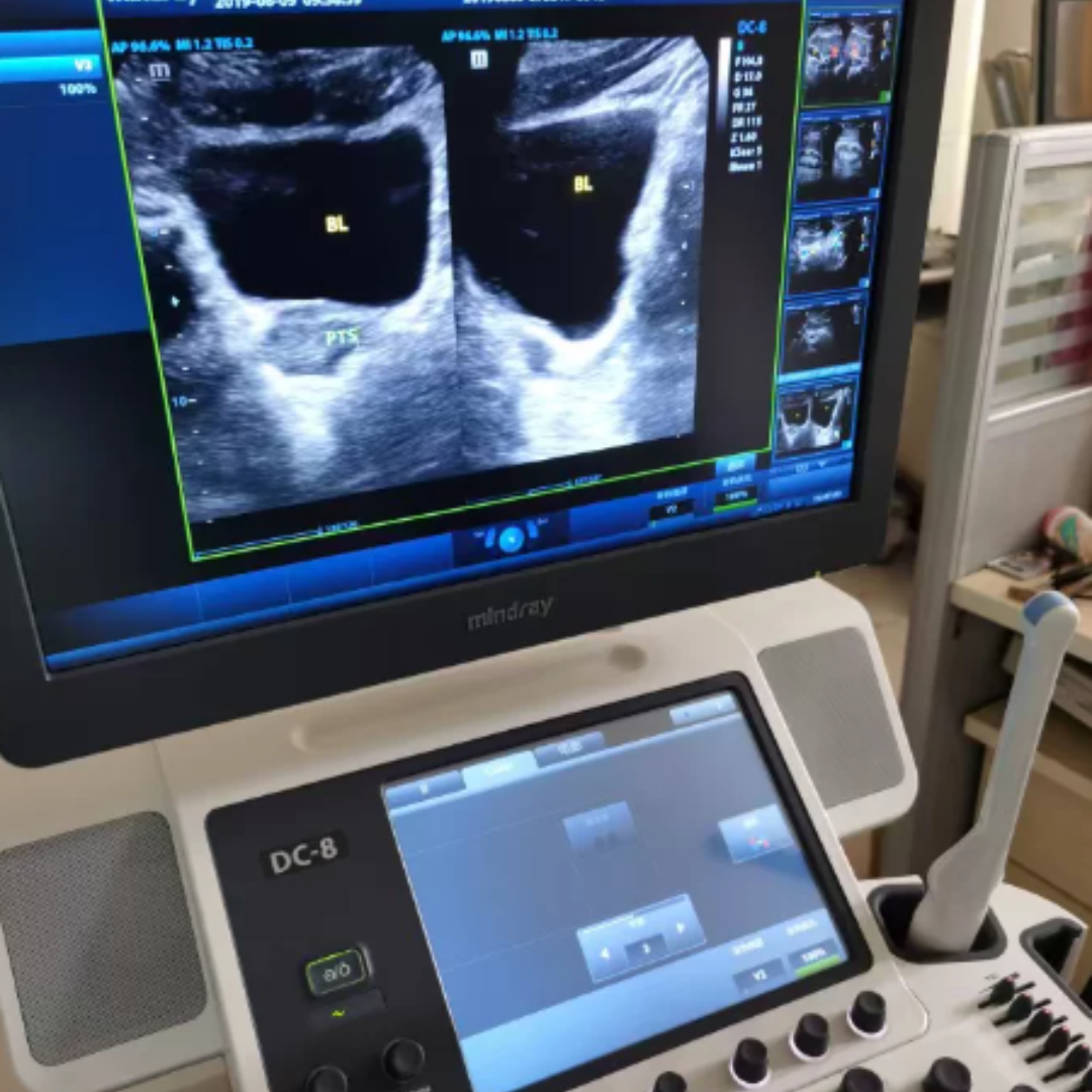 迈瑞彩超维修迈瑞DC-8 Mindray 编码器 按键 控制面板主板 通道板 维修(图4)