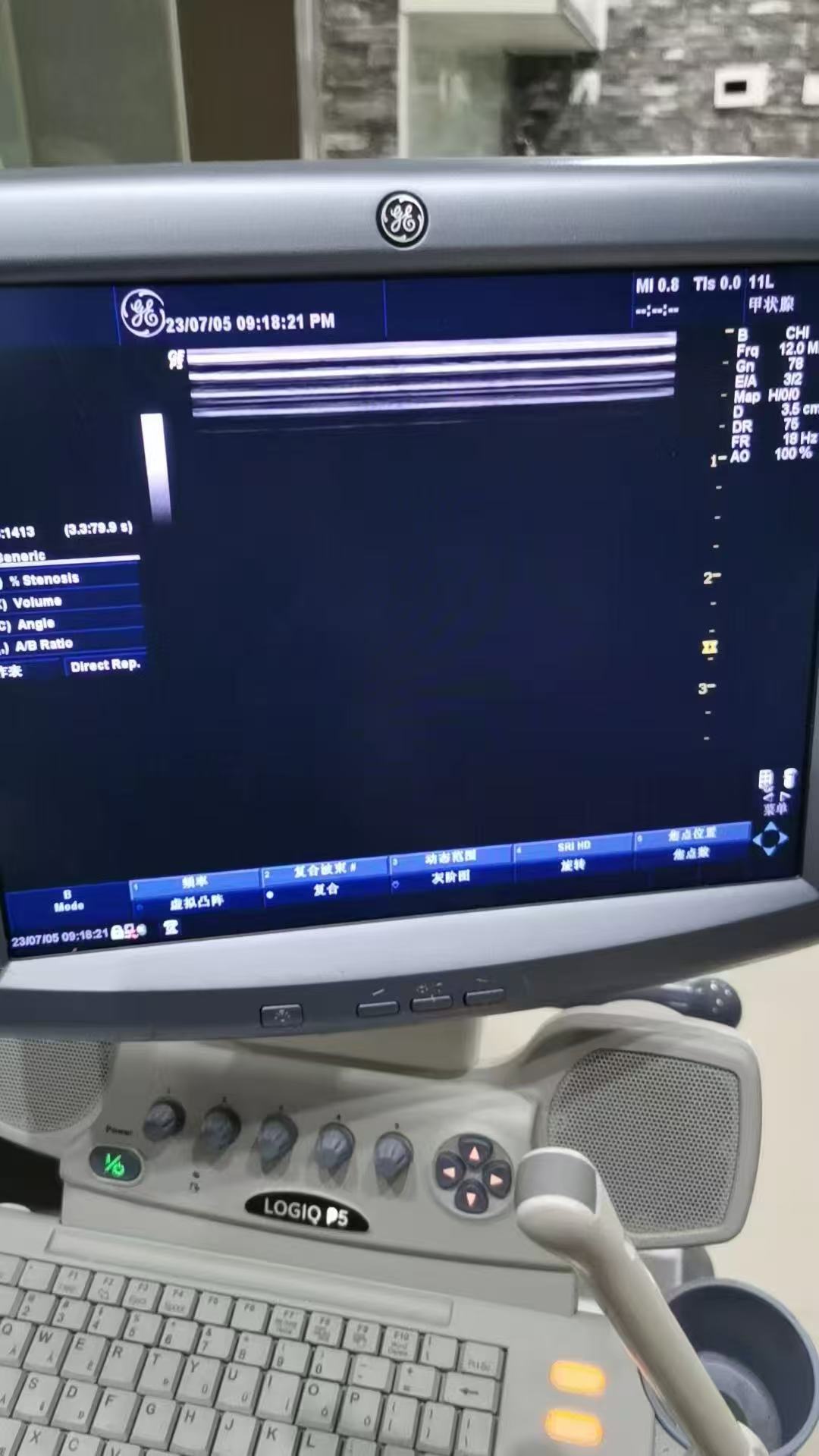二手GE LOGIQ P5 出口非洲(图6)