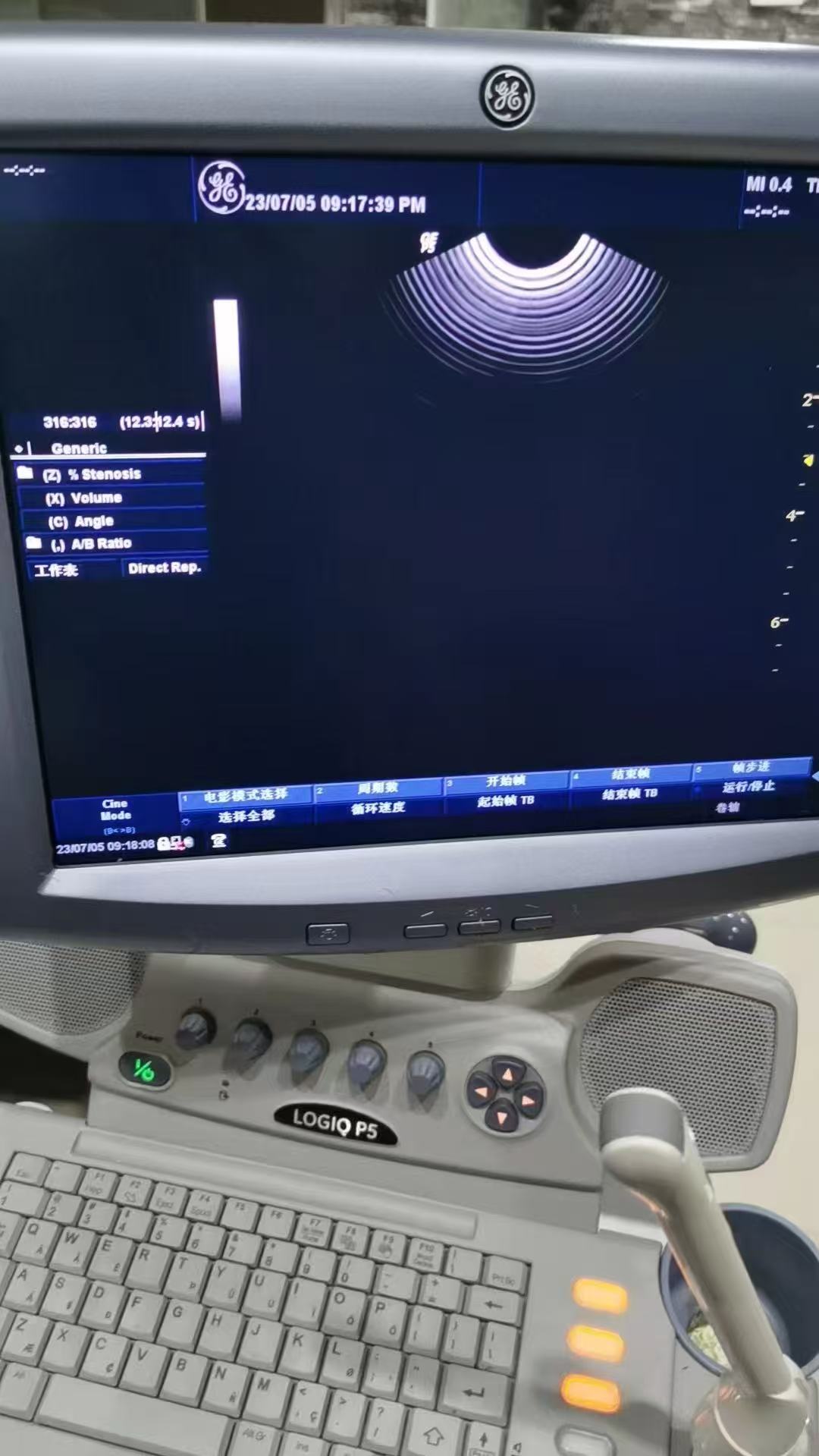 二手GE LOGIQ P5 出口非洲(图1)